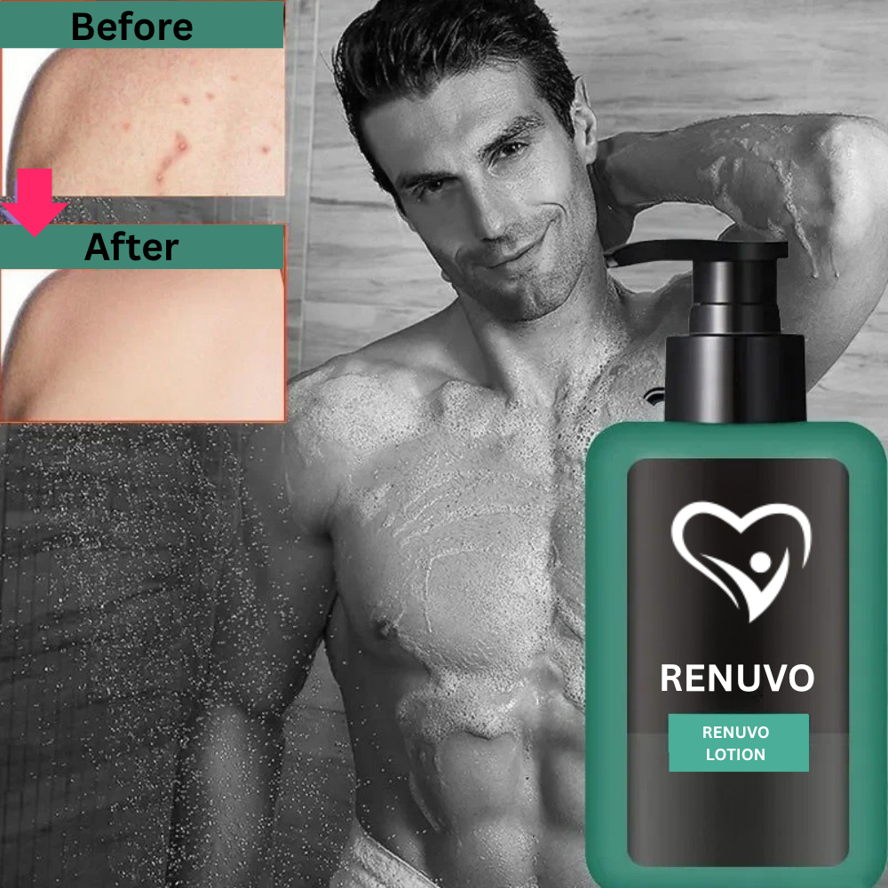 ReNuvo Lotion